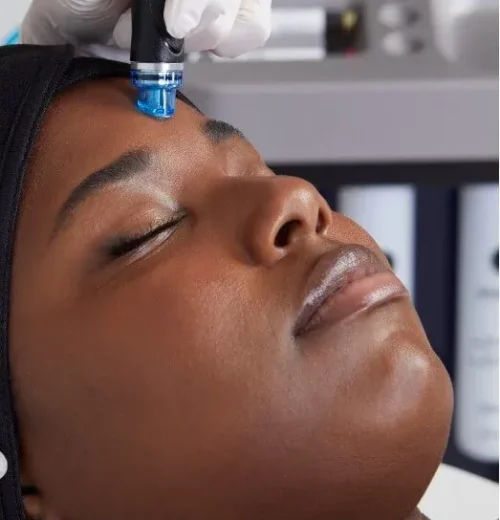 imgi_19_Hydrafacial+Tallahassee+FL+Aesthetician