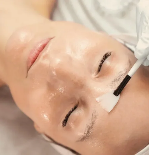 imgi_20_Chemical+Peels+Tallahassee+FL+Aesthetician